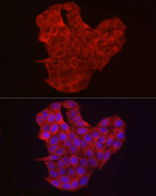 EXT1 Rabbit Polyclonal Antibody - Image 4