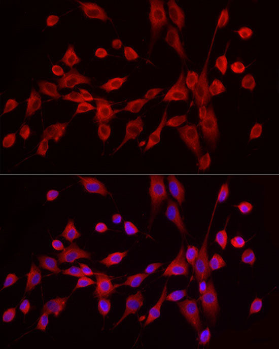 EXT1 Rabbit Polyclonal Antibody - Image 5