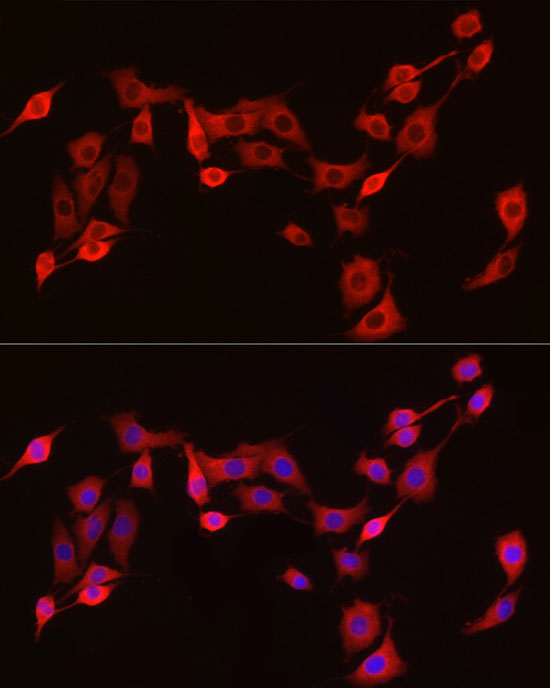 EXT1 Rabbit Polyclonal Antibody - Image 6