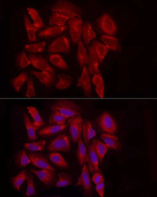 EXT1 Rabbit Polyclonal Antibody - Image 7