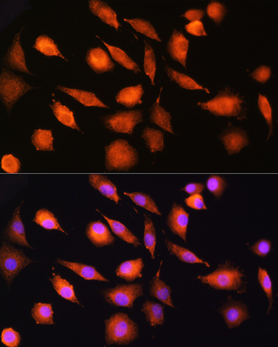 EXT2 Rabbit Polyclonal Antibody - Image 2