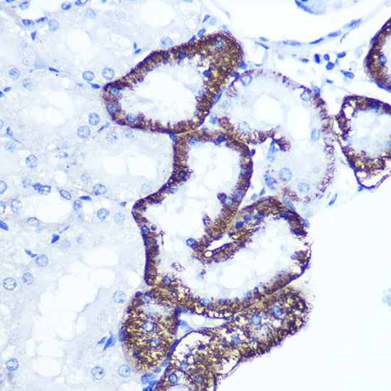 EXTL3 Rabbit Polyclonal Antibody - Image 2