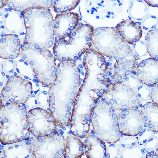 EXTL3 Rabbit Polyclonal Antibody - Image 3