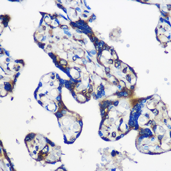 EYA1 Rabbit Polyclonal Antibody - Image 2