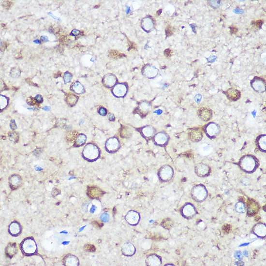 EYA1 Rabbit Polyclonal Antibody - Image 3