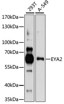 EYA2 Rabbit Polyclonal Antibody