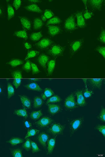 EYA3 Rabbit Polyclonal Antibody - Image 2