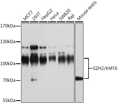 EZH2/KMT6 Rabbit Polyclonal Antibody