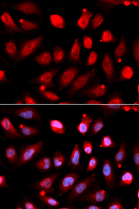 EZH2/KMT6 Rabbit Polyclonal Antibody - Image 2