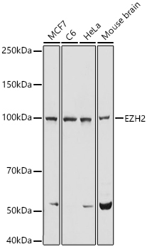 EZH2/KMT6 Rabbit Polyclonal Antibody