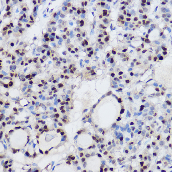 EZH2/KMT6 Rabbit Polyclonal Antibody - Image 2