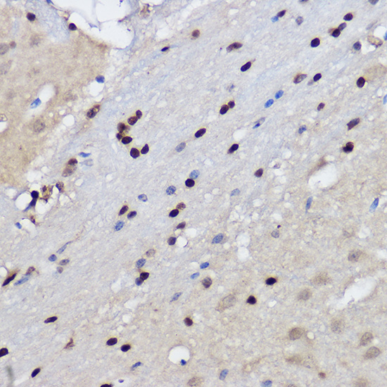 EZH2/KMT6 Rabbit Polyclonal Antibody - Image 3