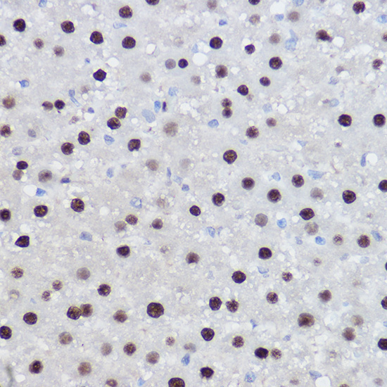 EZH2/KMT6 Rabbit Polyclonal Antibody - Image 4