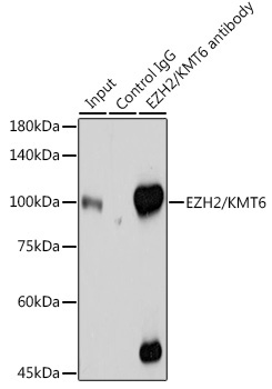 EZH2/KMT6 Rabbit Polyclonal Antibody - Image 5