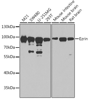 Ezrin Rabbit Polyclonal Antibody