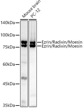 Ezrin/Radixin/Moesin Rabbit Polyclonal Antibody - Image 2