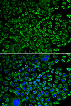 F10 Rabbit Polyclonal Antibody - Image 2
