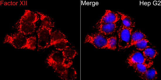 F12 Rabbit Polyclonal Antibody