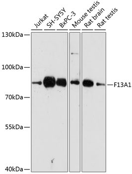 F13A1 Rabbit Polyclonal Antibody