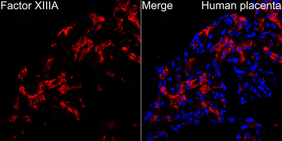 F13A1 Rabbit Polyclonal Antibody - Image 2