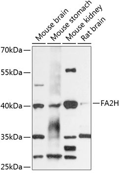 FA2H Rabbit Polyclonal Antibody