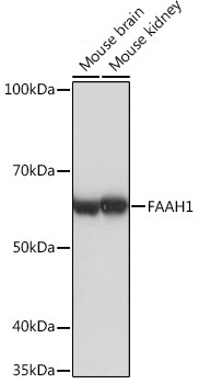 FAAH1 Rabbit Monoclonal Antibody