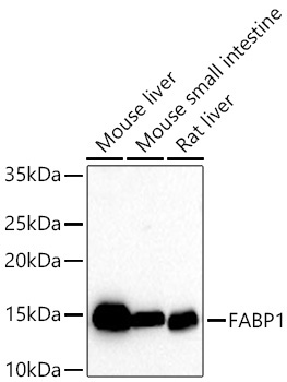 FABP1 Rabbit Monoclonal Antibody