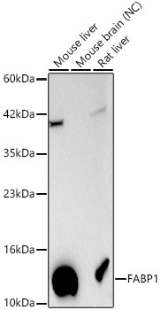 FABP1 Rabbit Polyclonal Antibody