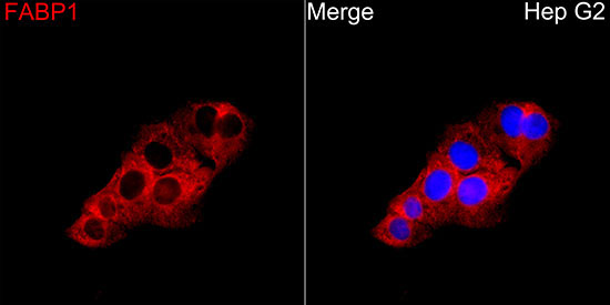 FABP1 Rabbit Polyclonal Antibody - Image 2