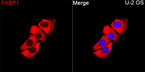 FABP1 Rabbit Polyclonal Antibody - Image 3