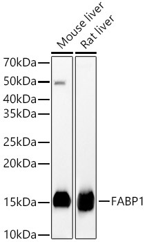 FABP1 Rabbit Polyclonal Antibody