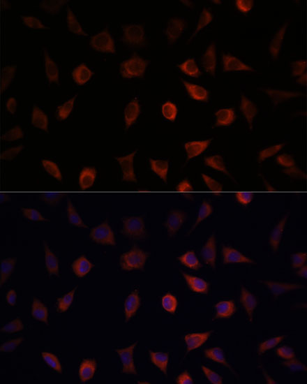 FABP1 Rabbit Polyclonal Antibody - Image 2
