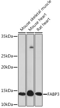 FABP3 Rabbit Monoclonal Antibody