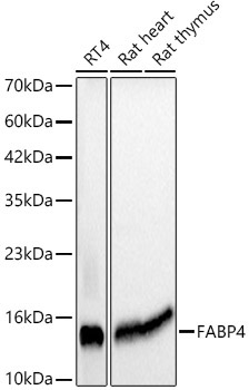 FABP4 Mouse Monoclonal Antibody
