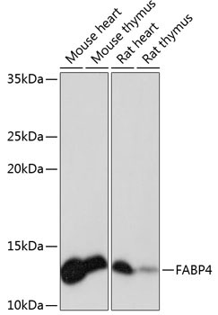 FABP4 Rabbit Monoclonal Antibody