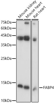 FABP4 Rabbit Polyclonal Antibody