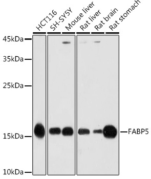 FABP5 Rabbit Polyclonal Antibody