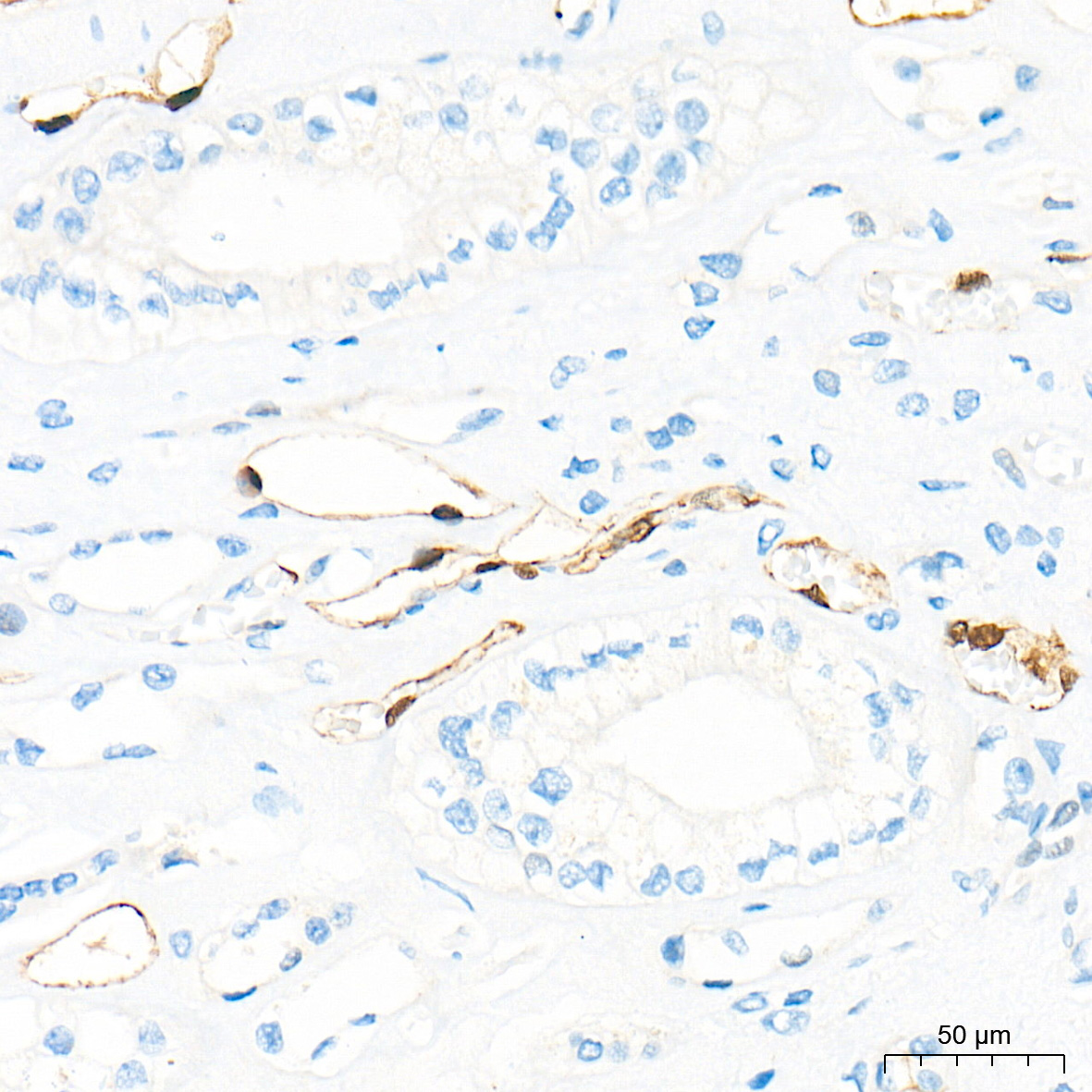 FABP5 Rabbit Polyclonal Antibody - Image 2