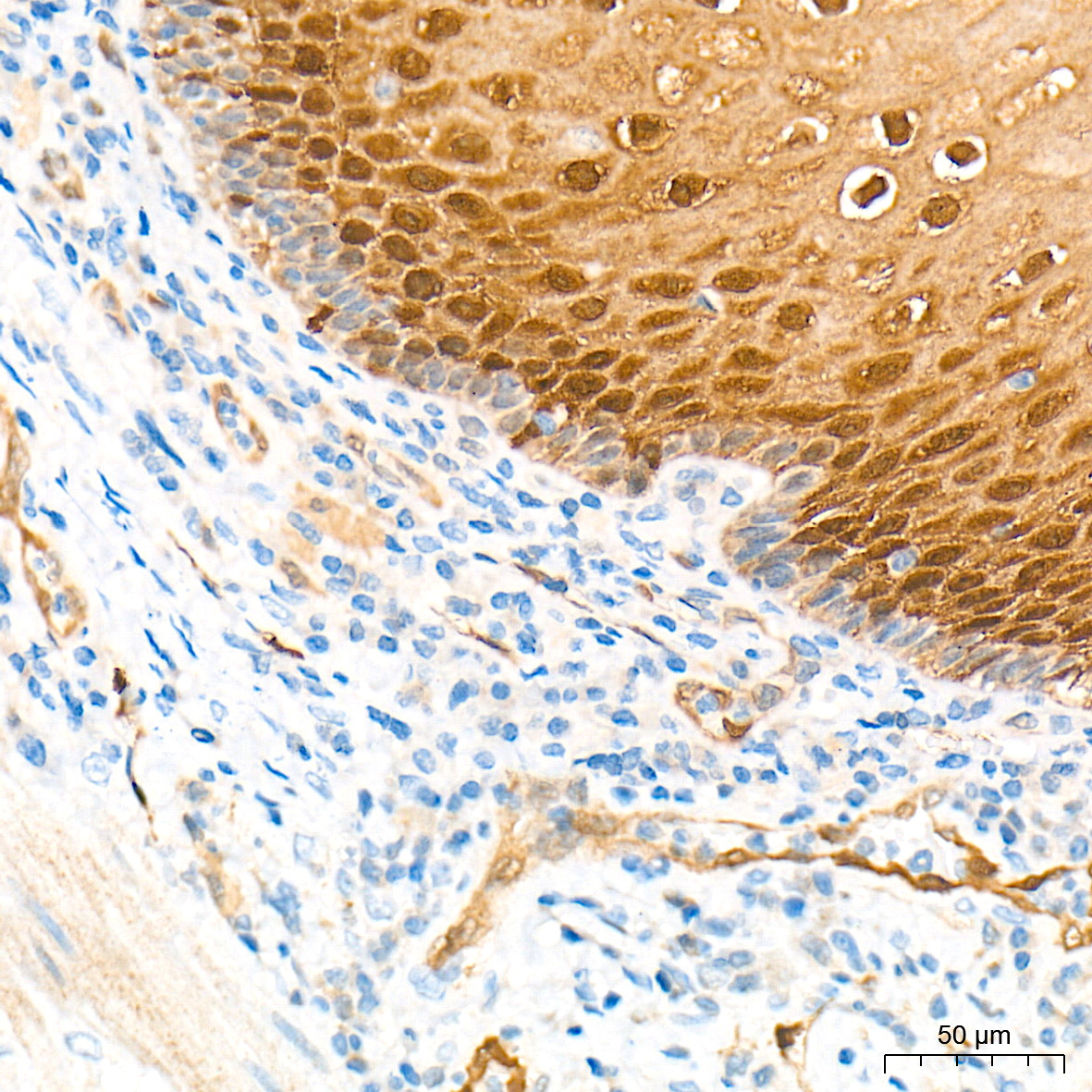 FABP5 Rabbit Polyclonal Antibody - Image 3