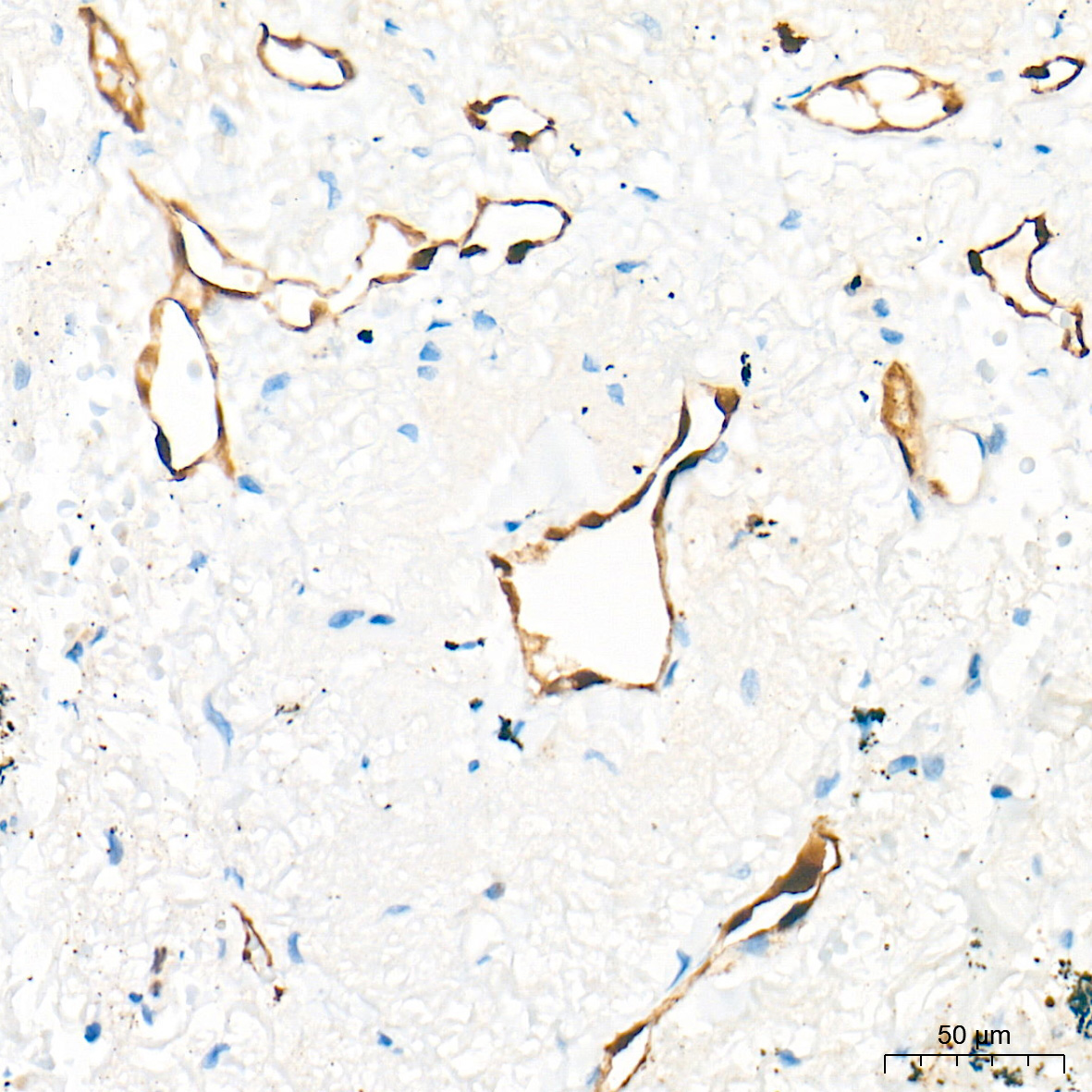 FABP5 Rabbit Polyclonal Antibody - Image 4