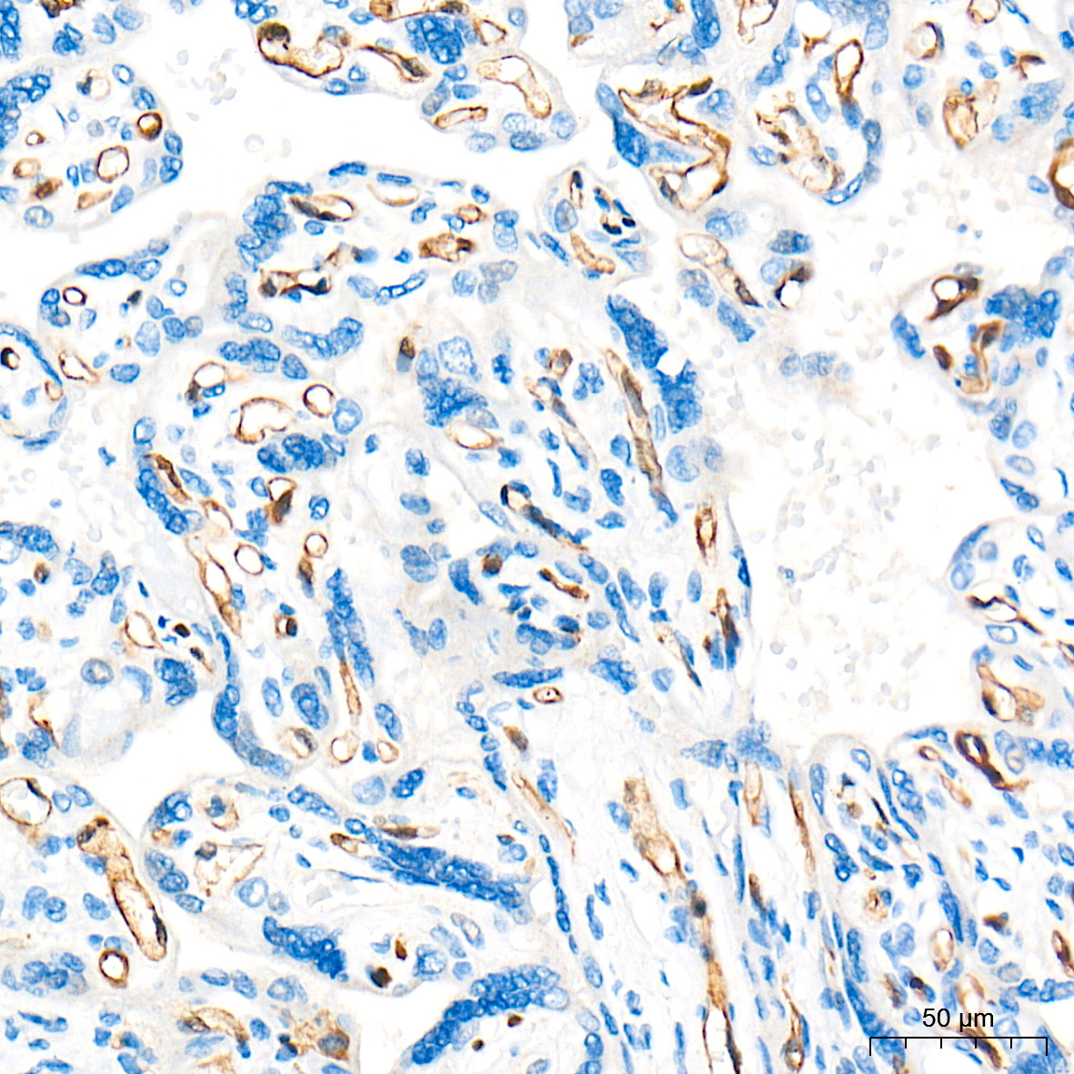FABP5 Rabbit Polyclonal Antibody - Image 5