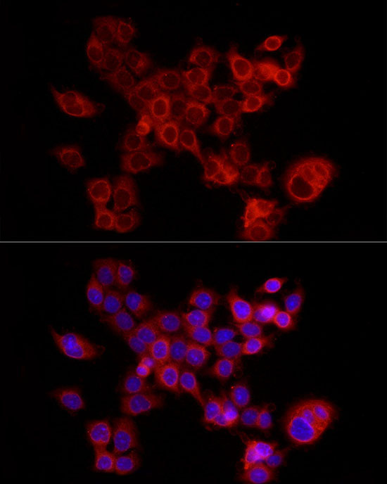 FABP5 Rabbit Polyclonal Antibody - Image 6