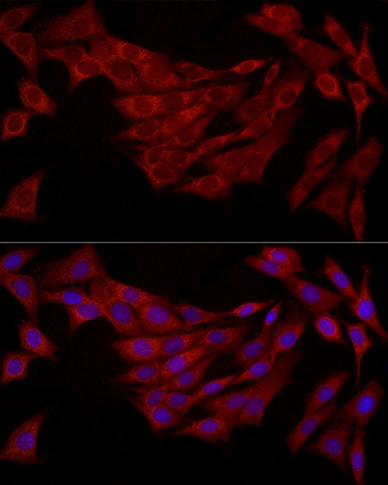 FABP5 Rabbit Polyclonal Antibody - Image 7
