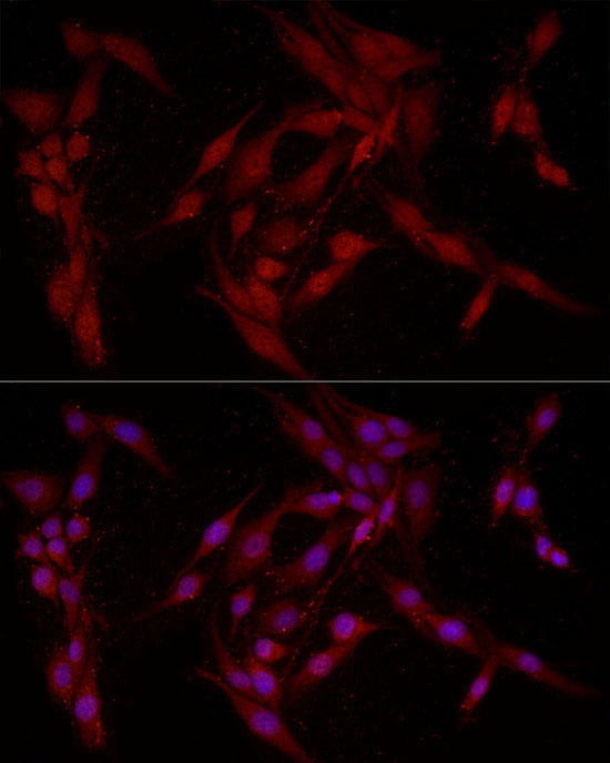 FABP5 Rabbit Polyclonal Antibody - Image 8