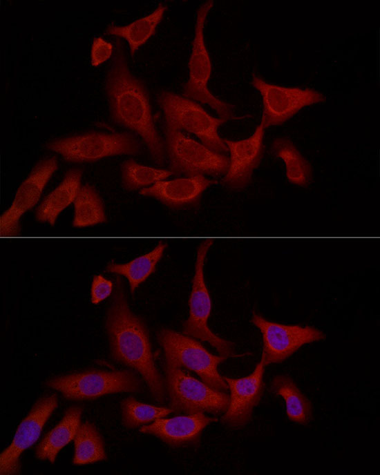 FABP5 Rabbit Polyclonal Antibody - Image 9