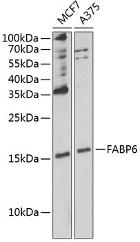 FABP6 Rabbit Polyclonal Antibody
