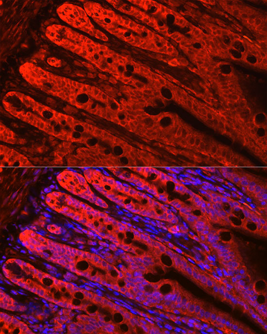 FABP6 Rabbit Polyclonal Antibody - Image 2