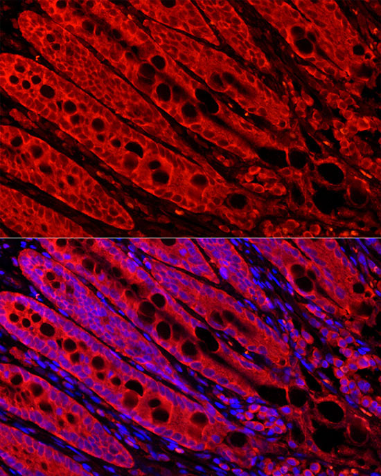 FABP6 Rabbit Polyclonal Antibody - Image 3