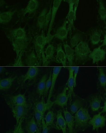 FABP7 Rabbit Polyclonal Antibody - Image 2