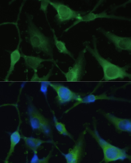 FABP7 Rabbit Polyclonal Antibody - Image 3